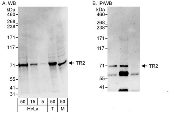 Rabbit TR2 Antibody