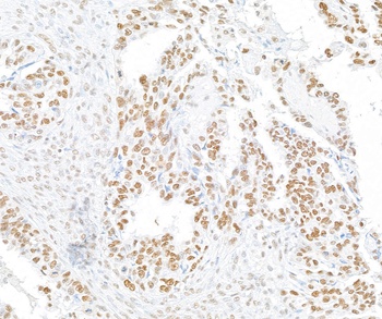 Rabbit RFX1 Antibody