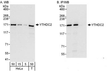 Rabbit YTHDC2 Antibody