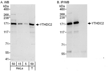 Rabbit YTHDC2 Antibody