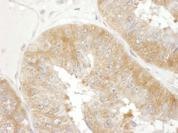 Rabbit eIF3F Antibody