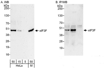 Rabbit eIF3F Antibody