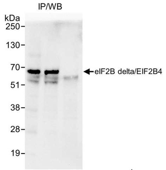 Rabbit eIF2B delta/EIF2B4 Antibody
