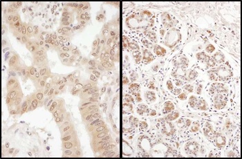 Rabbit eIF2B delta/EIF2B4 Antibody