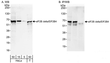Rabbit eIF2B delta/EIF2B4 Antibody