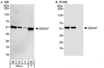 Rabbit DDX47 Antibody
