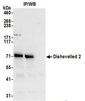 Rabbit Dishevelled 2 Antibody