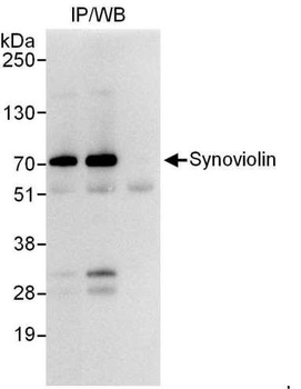 Rabbit Synoviolin Antibody