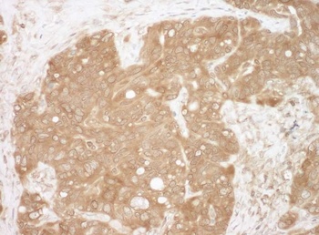 Rabbit CacyBP Antibody