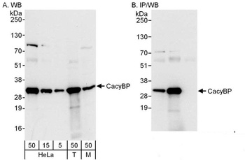 Rabbit CacyBP Antibody
