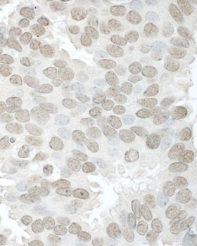 Rabbit Aly Antibody