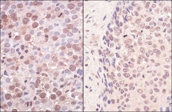 Rabbit SmcHD1 Antibody