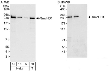 Rabbit SmcHD1 Antibody
