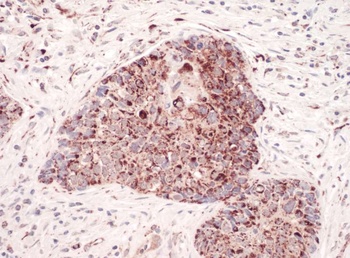 Rabbit C1QBP Antibody