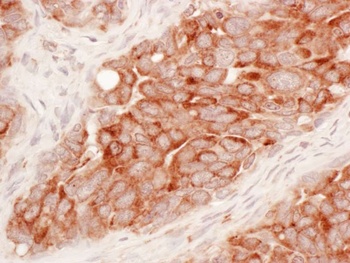 Rabbit Reticulon-3 Antibody