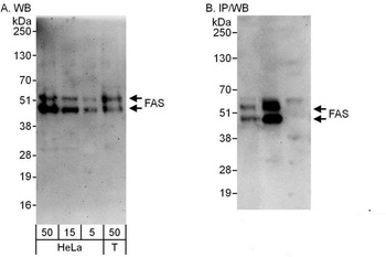 Rabbit FAS Antibody
