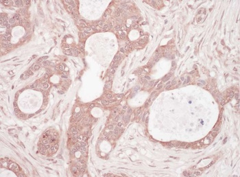 Rabbit Sequestosome-1 Antibody