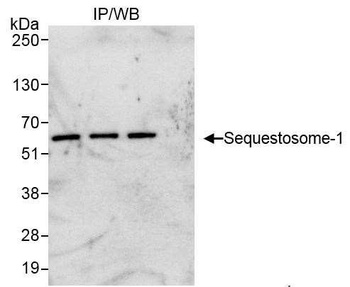 Rabbit Sequestosome-1 Antibody