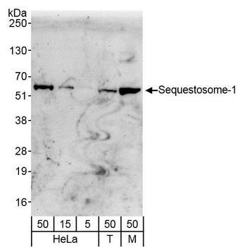 Rabbit Sequestosome-1 Antibody