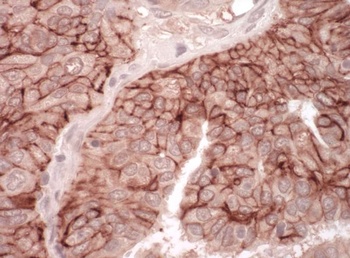 Rabbit CAR Antibody
