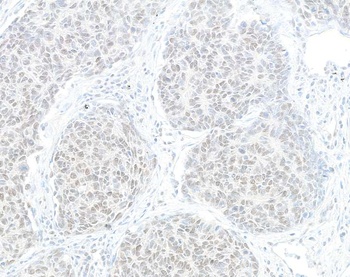 Rabbit HJURP Antibody