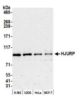 Rabbit HJURP Antibody