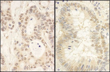 Rabbit FAF1 Antibody