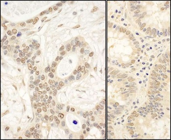 Rabbit FAF1 Antibody