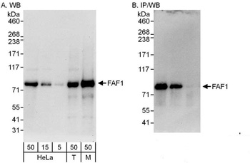 Rabbit FAF1 Antibody