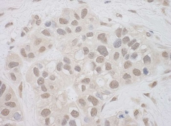 Rabbit SUPT7L Antibody