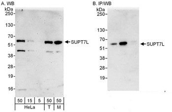 Rabbit SUPT7L Antibody