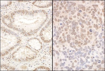 Rabbit PQBP1 Antibody