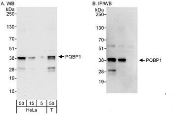 Rabbit PQBP1 Antibody