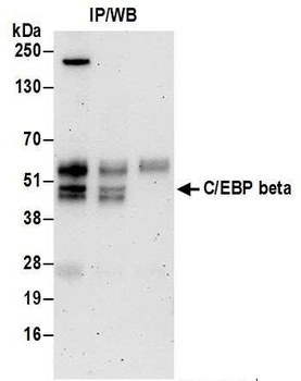 Rabbit anti-C/EBP beta Antibody