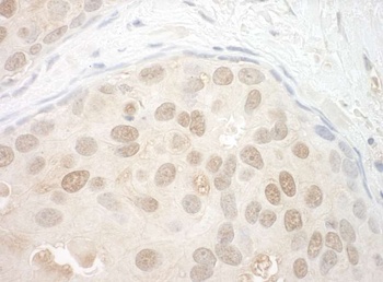 Rabbit ORC2 Antibody