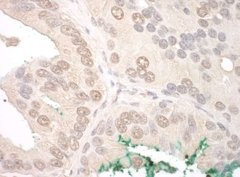 Rabbit ORC2 Antibody