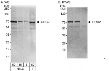 Rabbit ORC2 Antibody