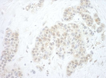 Rabbit Pygo2 Antibody
