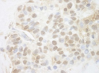 Rabbit Pygo2 Antibody