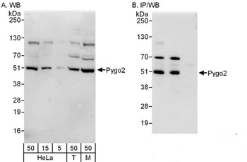 Rabbit Pygo2 Antibody