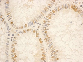 Rabbit NOP56 Antibody