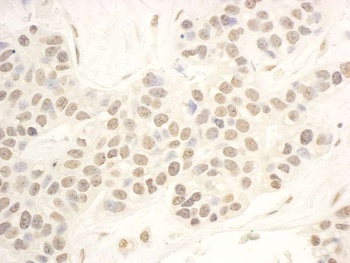 Rabbit NOP56 Antibody