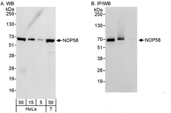 Rabbit NOP58 Antibody