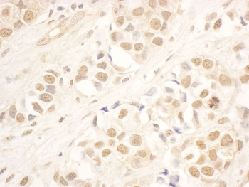 Rabbit NOP58 Antibody