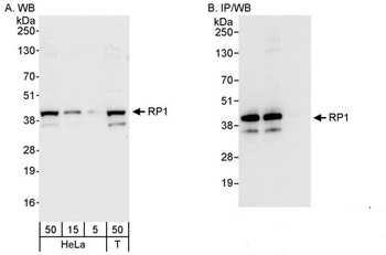 Rabbit RP1 Antibody