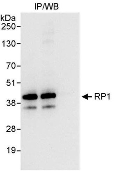 Rabbit RP1 Antibody