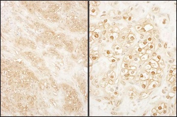 Rabbit PCTAIRE 2 Antibody