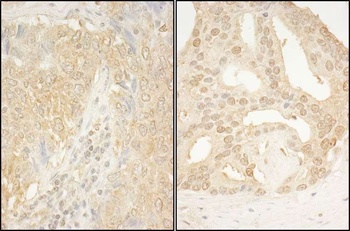 Rabbit CaMKK alpha Antibody