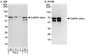 Rabbit CaMKK alpha Antibody