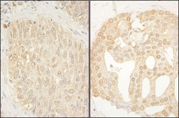 Rabbit CaMKK alpha Antibody